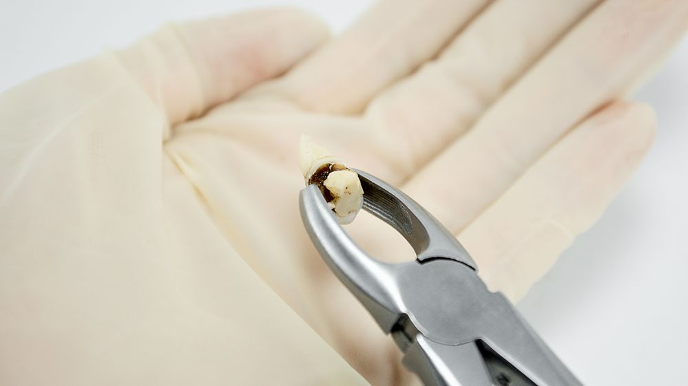 Šílený dentista trhal zuby na kolonožce, na dlouho dotrhal